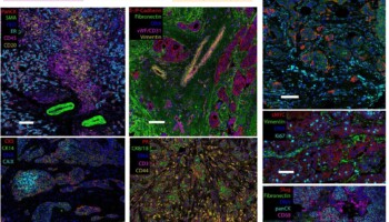 Extended Data Fig. 1: Antibody panel and example pseudocoloured images of markers. Extended Data Fig. 1: Antibody panel and example pseudocoloured images of markers.