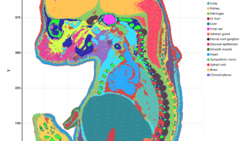 Mitamura, Yasutaka et al. “Spatial transcriptomics combined with single-cell RNA-sequencing unravels the complex inflammatory cell network in atopic dermatitis.” Allergy vol. 78,8 (2023): 2215-2231. doi:10.1111/all.15781 Mitamura, Yasutaka et al. “Spatial transcriptomics combined with single-cell RNA-sequencing unravels the complex inflammatory cell network in atopic dermatitis.” Allergy vol. 78,8 (2023): 2215-2231. doi:10.1111/all.15781